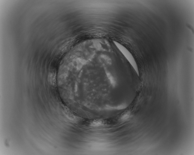 X0000099420177200805231638