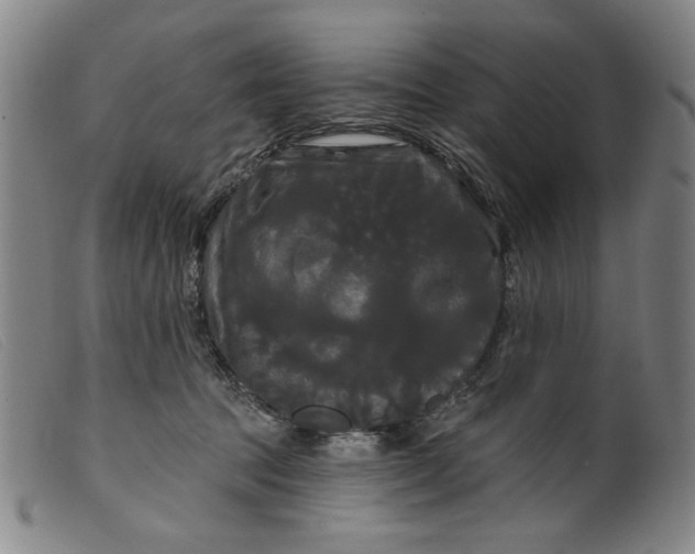 X0000099420369200805231635