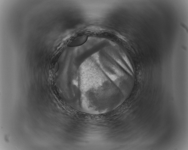 X0000099421397200805231618