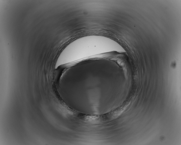 X0000099420139200805301415