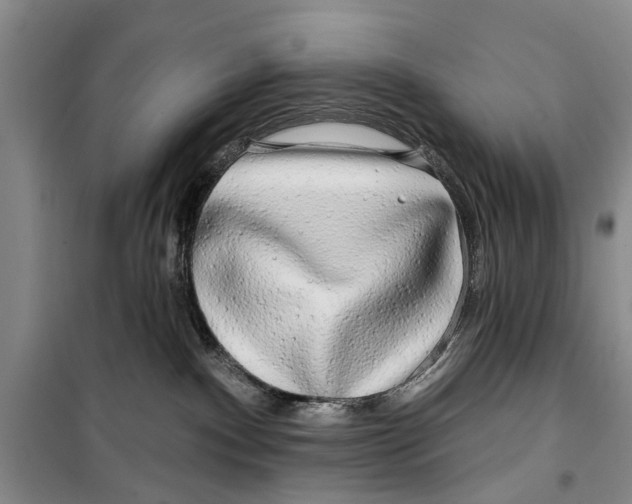 X0000099420140200805301415