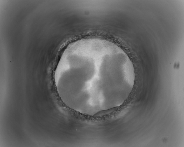 X0000099420144200805301415