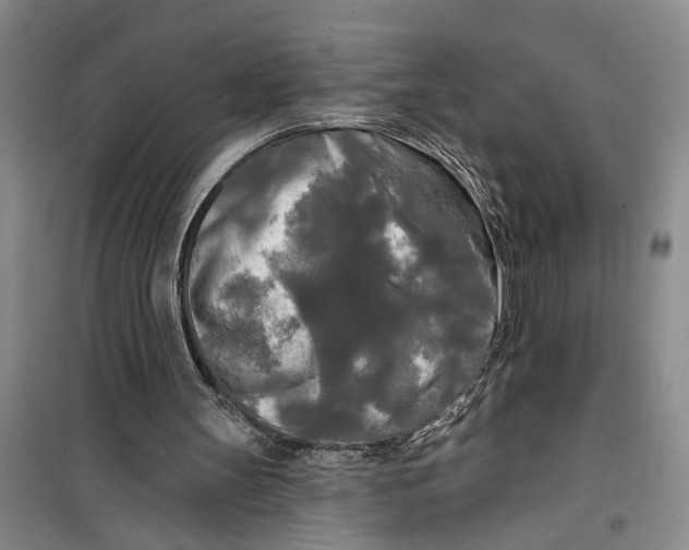 X0000099420147200805301414