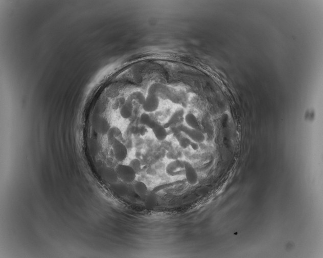 X0000099420149200805301414