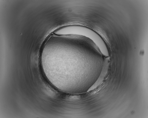 X0000099420156200805301414