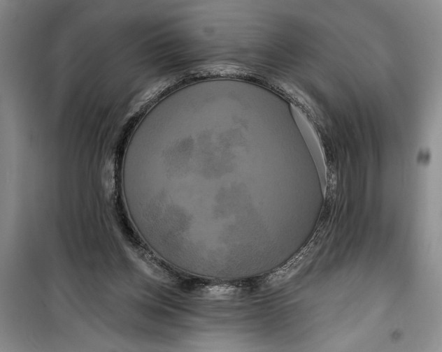 X0000099420158200805301415