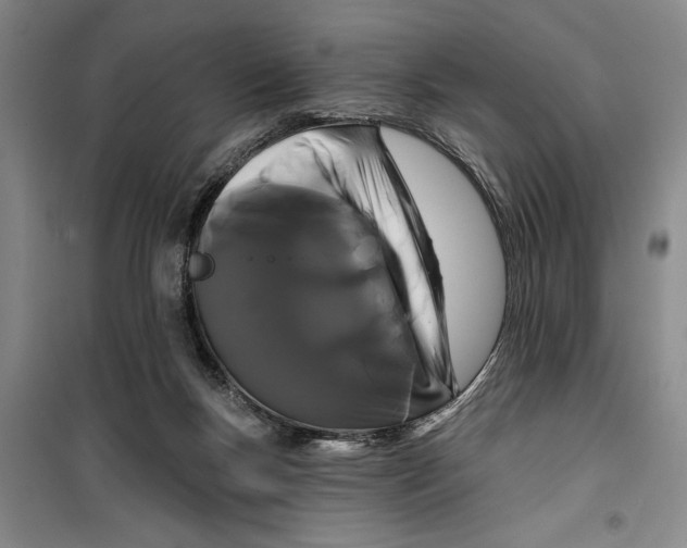 X0000099420167200805301415