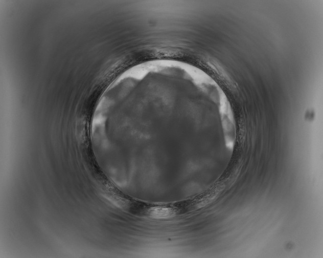 X0000099420169200805301415