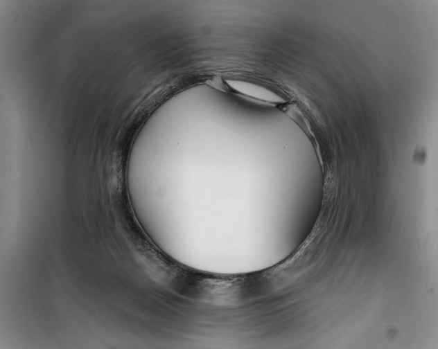 X0000099420170200805301415