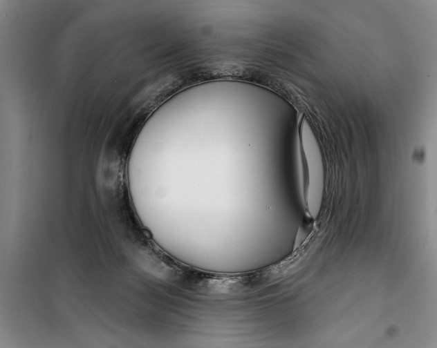 X0000099420172200805301415