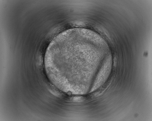 X0000099420173200805301415