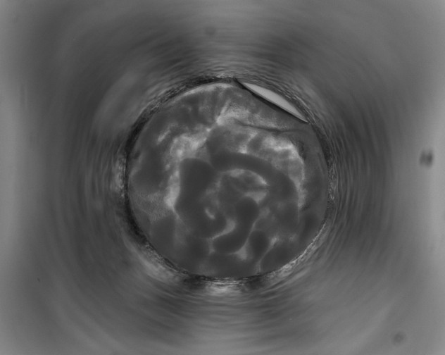 X0000099420175200805301415