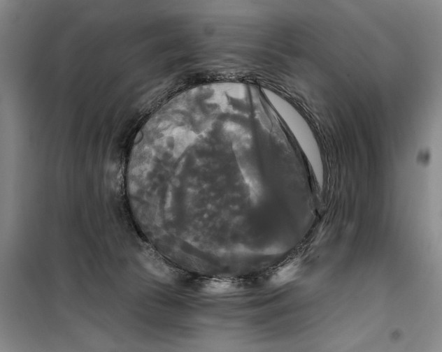 X0000099420177200805301415