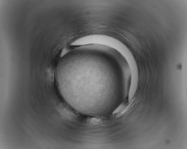 X0000099420180200805301415