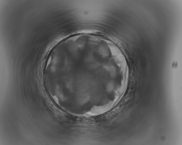 X0000099420337200805301412