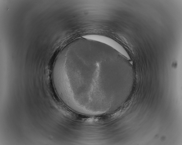 X0000099420366200805301412