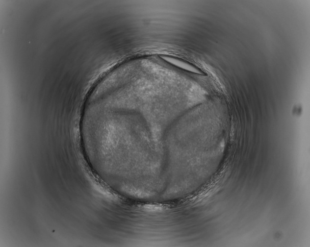 X0000099420394200805301412