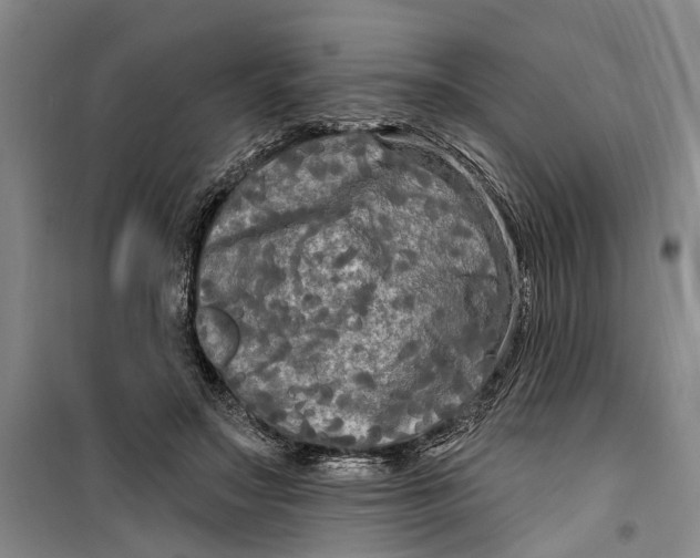 X0000099420499200805301410