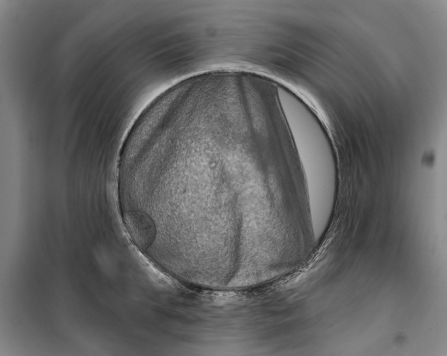 X0000099420903200805301404