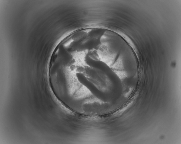 X0000099420957200805301404