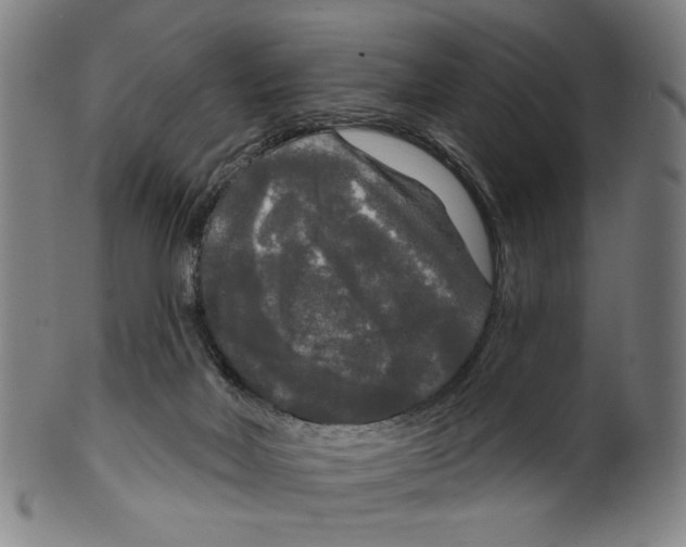 X0000099420026200806061005