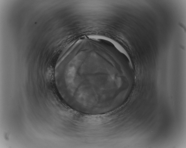 X0000099420029200806061005
