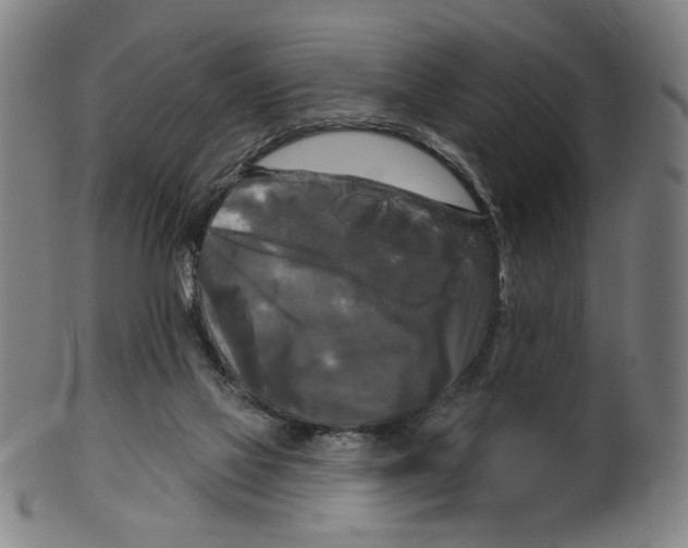 X0000099420069200806061005