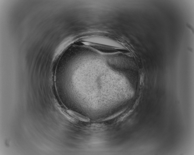 X0000099420101200806061004