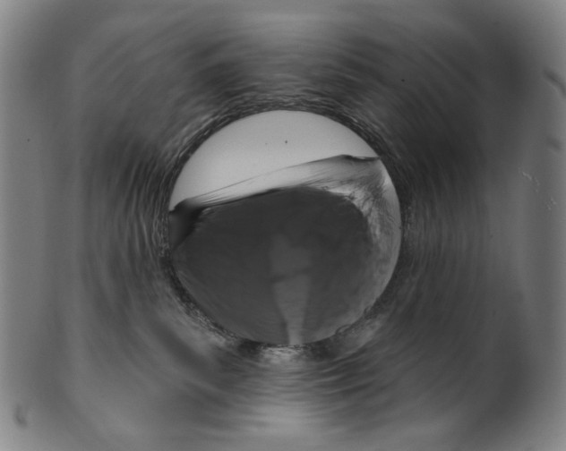 X0000099420139200806061004