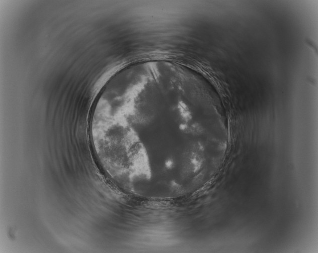 X0000099420147200806061003