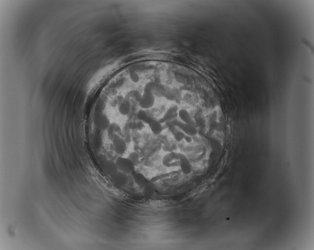 X0000099420149200806061003