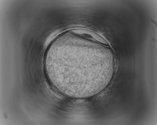 X0000099420151200806061003