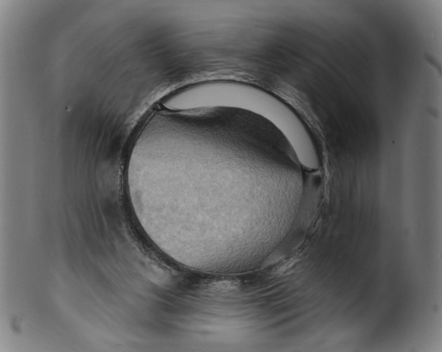 X0000099420156200806061003