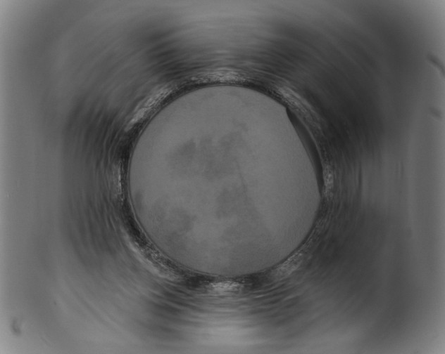 X0000099420158200806061003