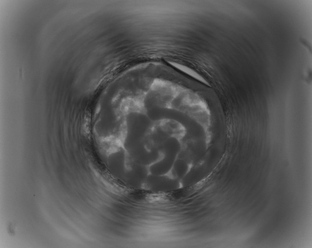 X0000099420175200806061004