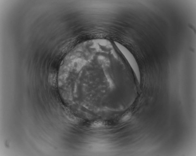 X0000099420177200806061004