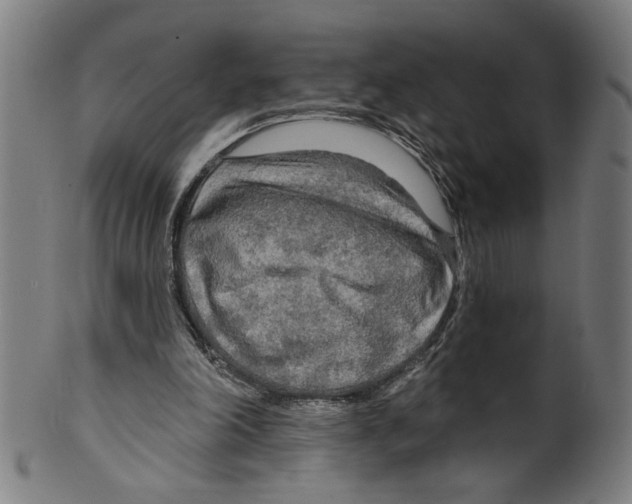 X0000099420198200806061003