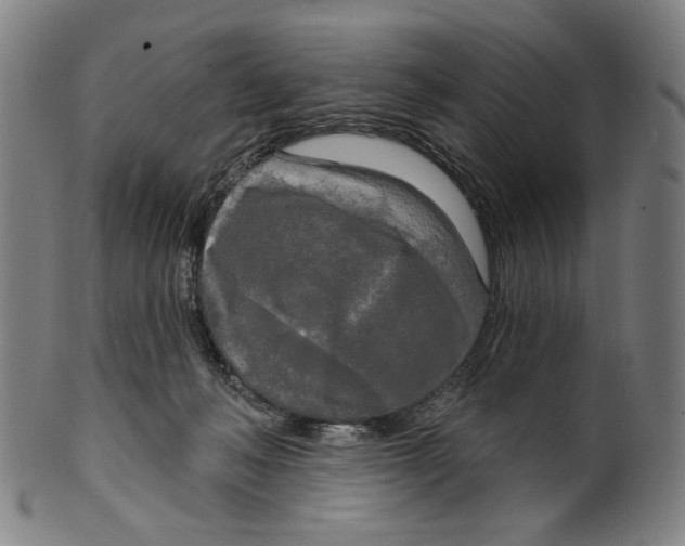 X0000099420222200806061003