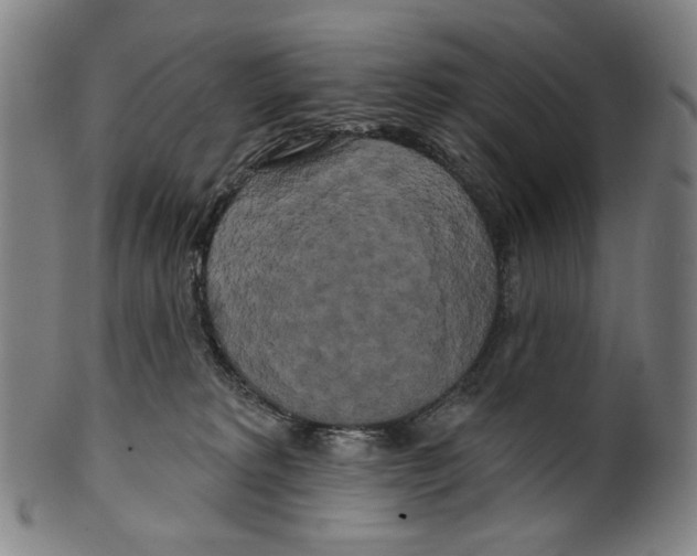 X0000099420229200806061003