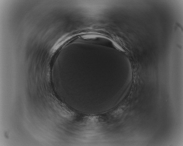 X0000099420295200806061002