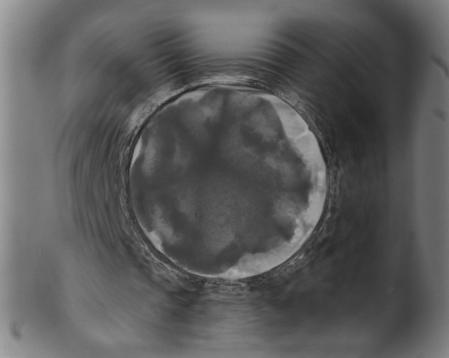X0000099420337200806061000
