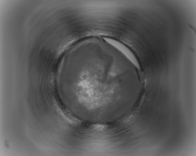 X0000099420352200806061000