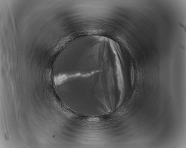 X0000099420357200806061001