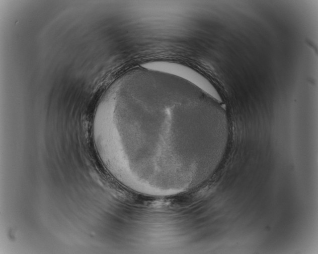 X0000099420366200806061001