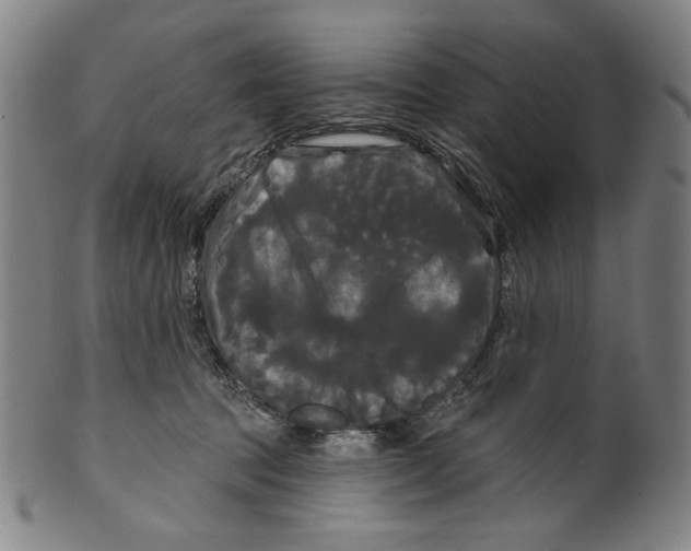 X0000099420369200806061001