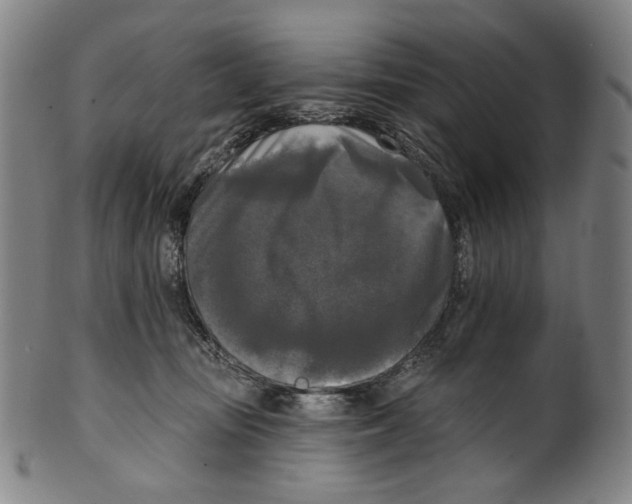X0000099420371200806061001