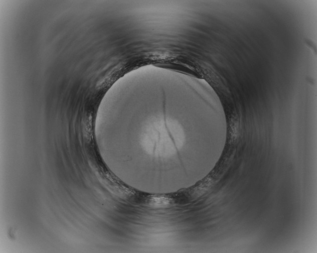 X0000099420376200806061001