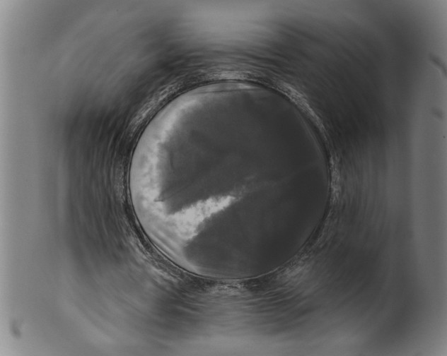X0000099420386200806061000