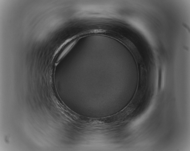 X0000099420387200806061000