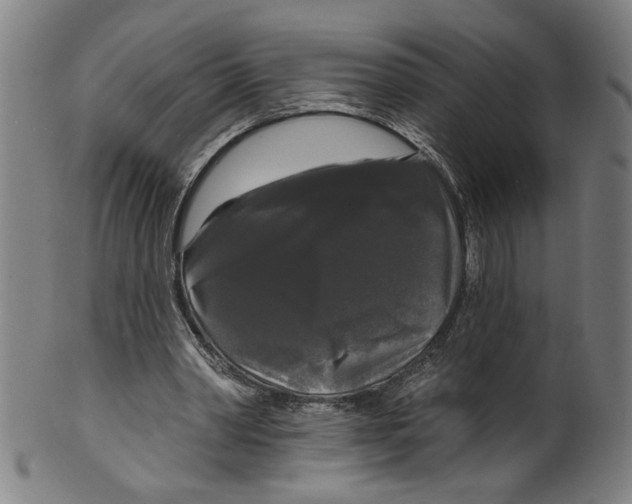 X0000099420390200806061000